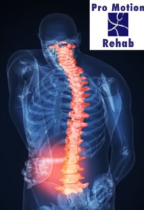 Spinal Stenosis Therapy